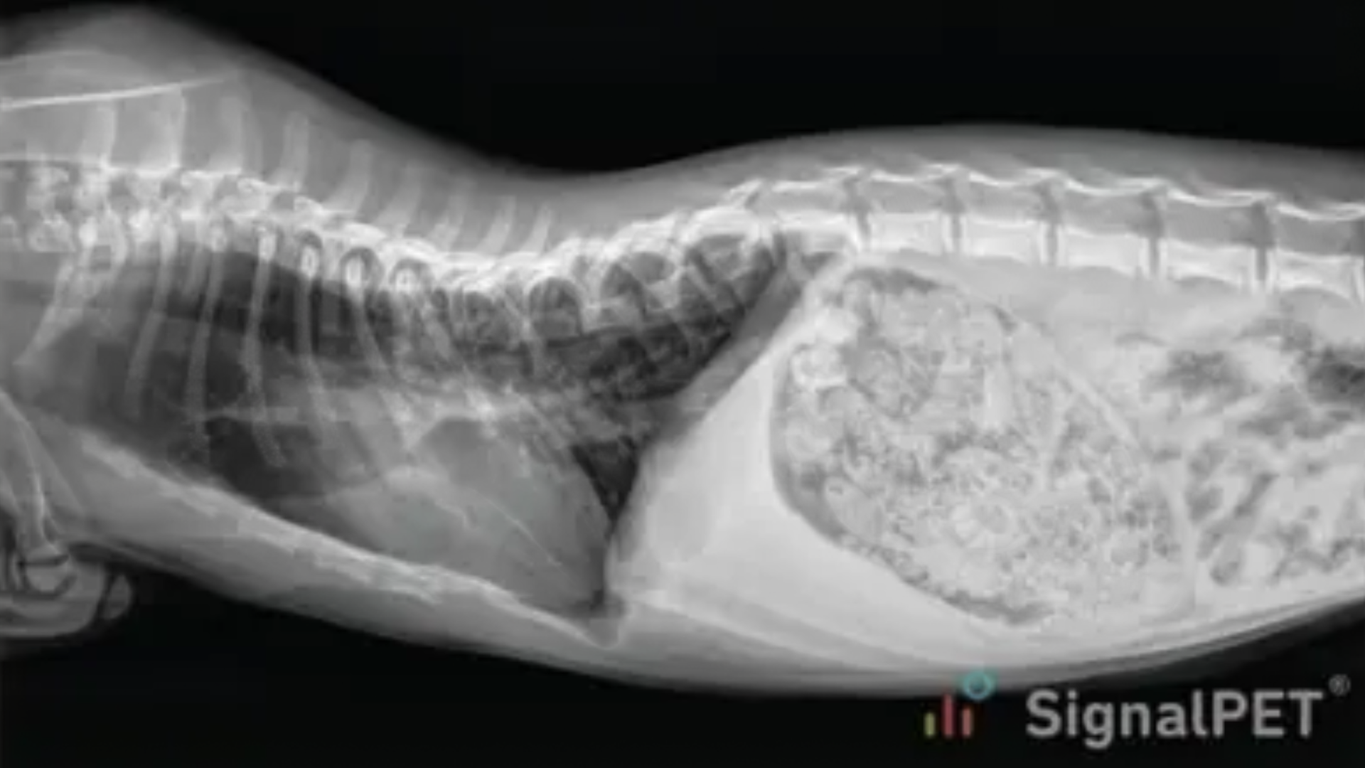 脊柱前凸症(Lordosis)